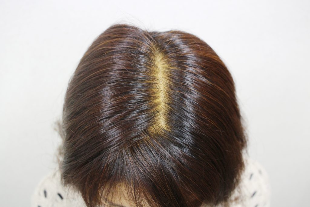 頭皮がオレンジ色